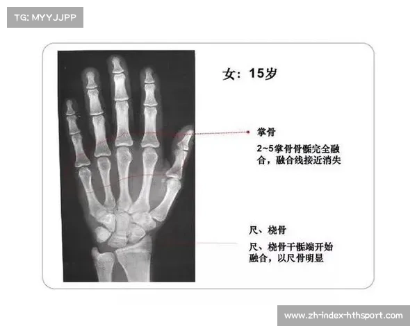 18 岁骨骺线未闭合?科学 3 招助你再长高 5cm 18 岁骨骺线未闭合?科学 3 招助你再长高 5cm